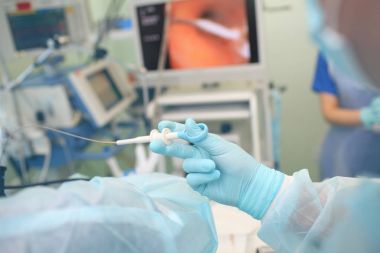 Kadın doktor endoskopi yordamı hastanede gerçekleştirir.