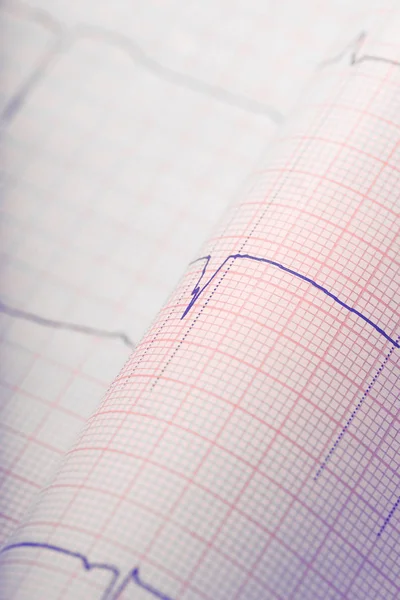 Cardiogram on the bended paper — Stock Photo, Image