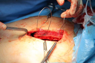 Ameliyathane, cerrahın rutin eser