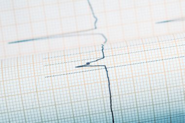 EKG karmaşık çizgi çizim kağıt üzerinde