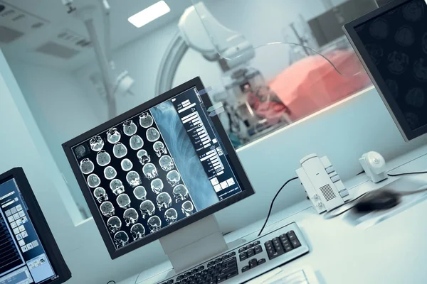 Exploración de Roentgen del paciente con enfermedad neurológica — Foto de Stock