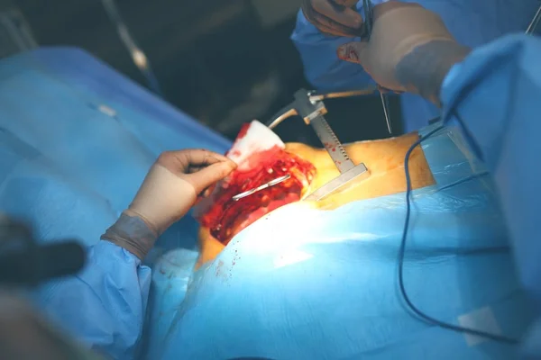 Squadra di chirurghi che eseguono una procedura chirurgica — Foto Stock