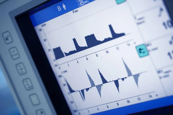 Artificail plicní ventilace monitor v jednotce intenzivní péče — Stock fotografie