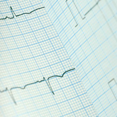 Tıbbi bir arka plan olarak bükülmüş EKG kağıt