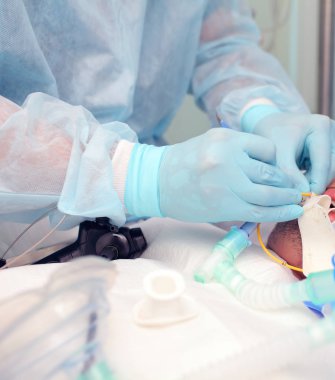 Doktor hastaya terapötik Bronkoskopi gerçekleştirme