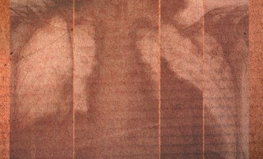 Karton, pulmonar kavramı üzerinde akciğer röntgen projeksiyon