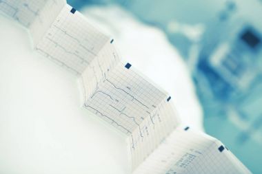 EKG izleme hasta yatağı arka planda katlanmış