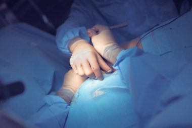 Ameliyat işlemi sırasında iki cerrah uyumlu çabaları