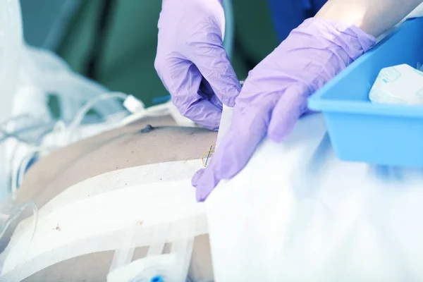 Dokter verandert de pleisters aan de patiënt na de operatie — Stockfoto