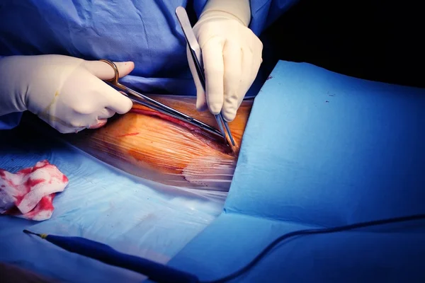 Cirujano comienza a trabajar en el quirófano con una incisión en la piel — Foto de Stock