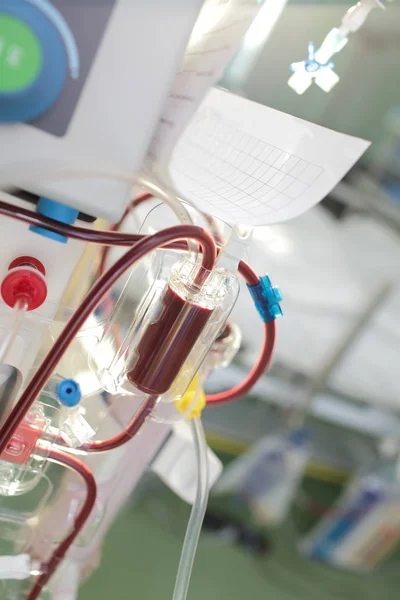 Technical unit with tubes filled with blood in the hospital ward — Stock Photo, Image