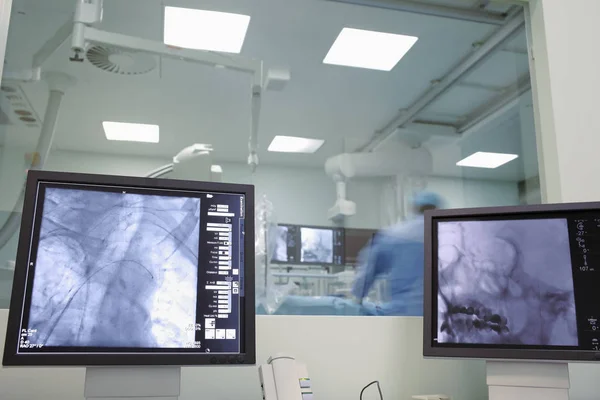 X-ray monitoring of neurosurgery on human brain in the hospital — Stock Photo, Image