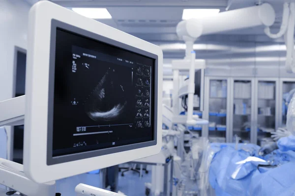 Ultraschall Diagnoseverfahren Der Modernen Fortgeschrittenen Medizinischen Praxis Bildschirm Einer Echokardiogrammmaschine — Stockfoto