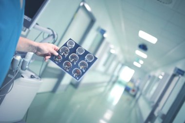 Erkek Doktor hastanın Mr resmi hastane h inceliyor