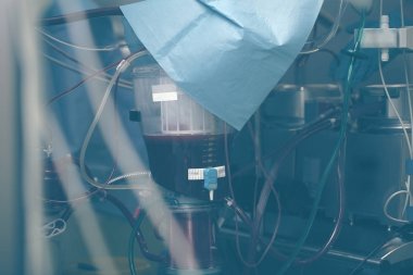 Tüp, su depoları ve modern medica tanklarda karmaşık sistem