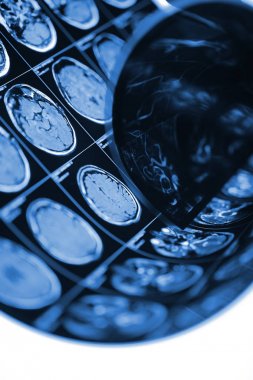 Hastanın başına hastanede ışık kutusu üzerinde tarama