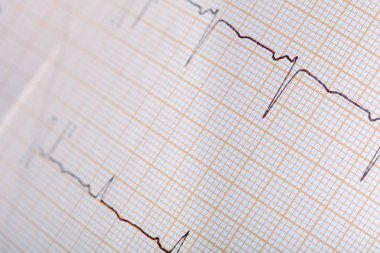 EKG izleme ile tasarım için tıbbi geçmişi