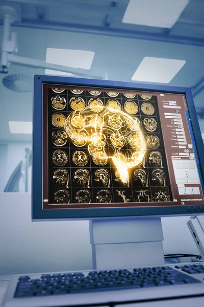 Lidský mozek Ct projekce na lékařské monitoru — Stock fotografie