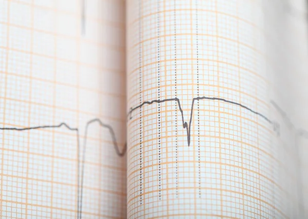 EKG-rutat papper som hälsa bakgrund med plats för din ska införas — Stockfoto