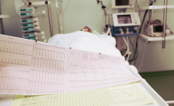EKG pacient ve vážném stavu na JIP — Stock fotografie
