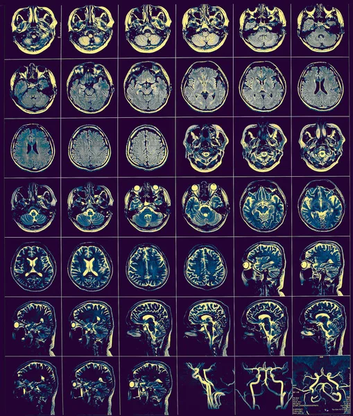 Film CT comme fond de diagnostic médical — Photo