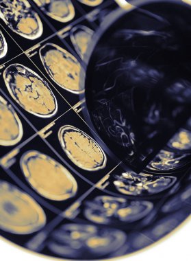 CT resim tanılama denetim kavramı olarak insan beyninin