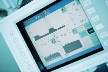 Dijital ekipman monitör grafikleri ile