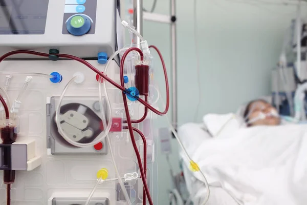 Equipamento médico para diálise sanguínea de um paciente gravemente doente — Fotografia de Stock