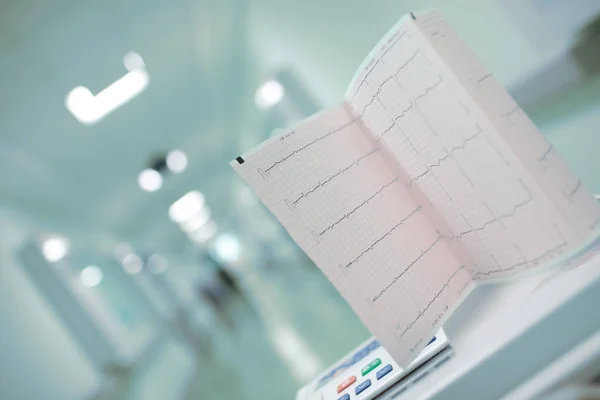 Gráfico de ECG doblado contra la sala borrosa del hospital, concepto de d — Foto de Stock