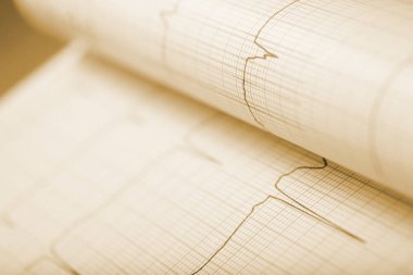 Çizgi grafiği ile ölçekli kağıt levha