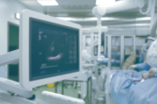 手术室心脏功能的超声监测 — 图库照片
