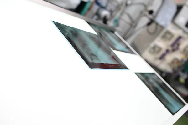 病室でライト ボックスの x 線像 — ストック写真
