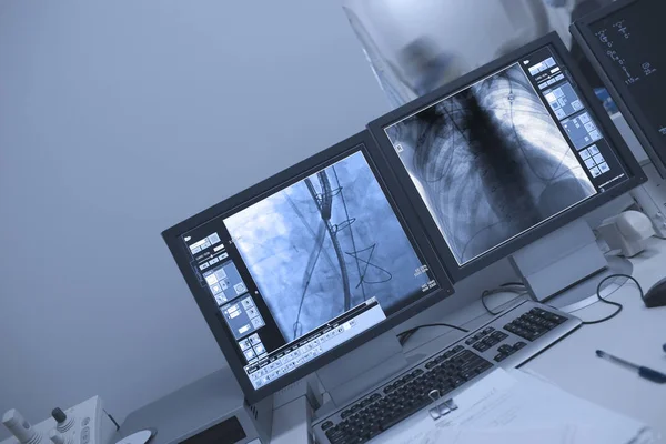 X-ray kontroll av patientens bröstkorg cavitywith avancerad teknik — Stockfoto