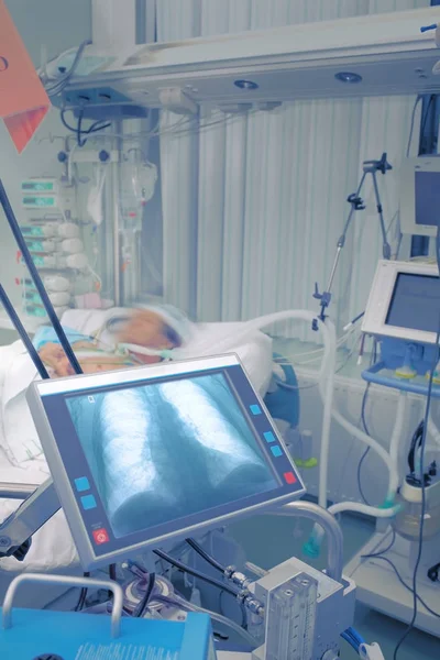 Étude radiographique du thorax du patient sur l'écran de l'ordinateur médical — Photo