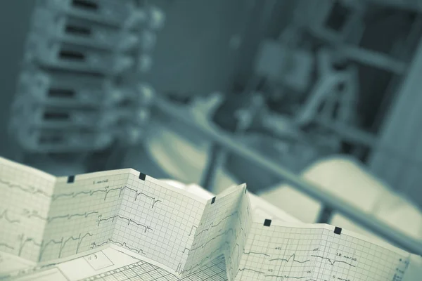 Bended ECG record on the nursing table the patient bedside — Stock Photo, Image