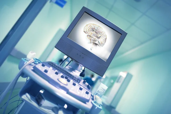Зображення мозку людини на дисплеї медичного обладнання в шлангах — стокове фото