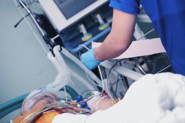 Unconsciuos hastanın EKG yapay akciğer havalandırmalı 