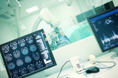 Camın arkasındaki odada yapılan muayene sırasında hastanın bilgisayarındaki MR taraması sırasında hastaya karşı. İnsan beyni üzerinde bilgisayar çalışması kavramı.