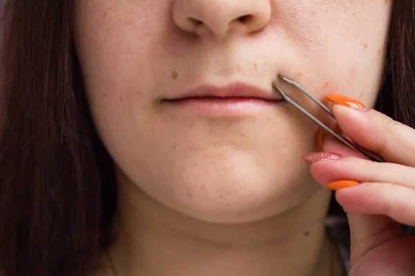 girl removes hair over her upper lip, female mustache with sharp tweezers at home. beauty treatments, hair removal.