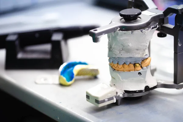 Articulador de gesso dental na mesa de trabalho no laboratório odontológico — Fotografia de Stock