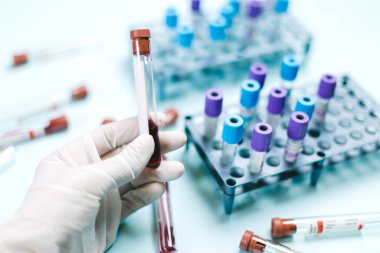 Eldivenli doktor kan tüpünü inceliyor. Kan testi