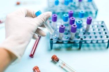 Tıbbi eldivenli doktor, analiz laboratuvarında tıbbi örneklerle dolu bir şişeyle ilgileniyor.