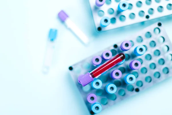 Rohrprobe mit Blutprobe über einer Harke mit medizinischen Proben im Labor für medizinische Analyse. — Stockfoto