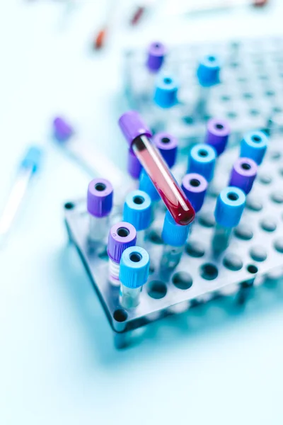 Röhrchen mit Blutprobe über einer Harke mit medizinischen Proben im Labor für medizinische Analyse. — Stockfoto