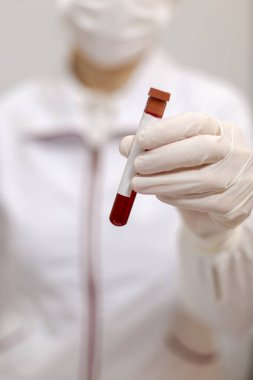 Maskeli ya da eldivenli bir doktor tıbbi analiz tüpü, kan ve metne uygun plazma tutuyor.