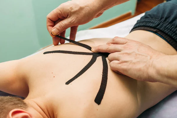 Fisioterapeuta Colocando Cinta Kinesio Espalda Del Paciente —  Fotos de Stock