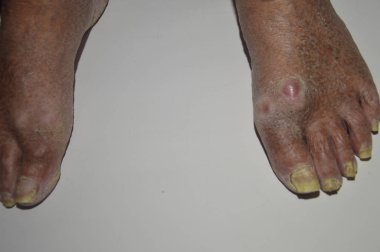 Beyaz arka planda yaşlı ve yaralı kadın ve erkeklerin ayakları