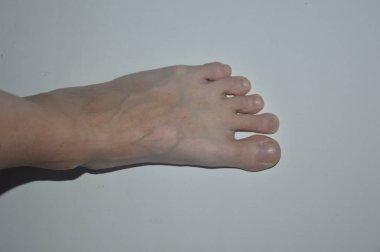 Beyaz arka planda yaşlı ve yaralı kadın ve erkeklerin ayakları