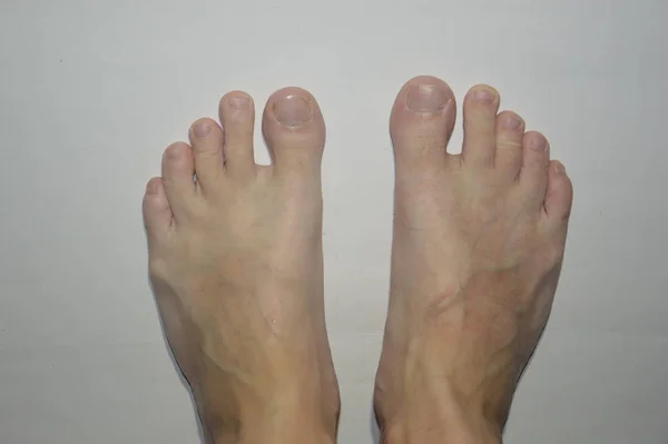 Beyaz arka planda yaşlı ve yaralı kadın ve erkeklerin ayakları