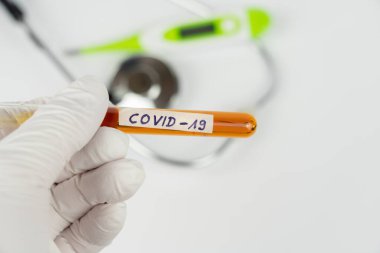 Üzerinde kan örneği olan bir laboratuvar tüpü ve Covid-19 izi olan bir el.